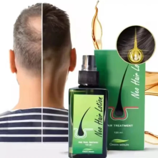 Лосьон для роста волос от облысения и выпадения Neo Hair Lotion 120 мл. (Оригинал) Таиланд