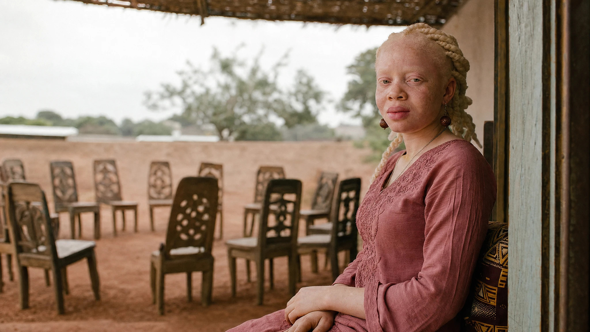 How COVID-19 amplified ritual attacks on people with albinism