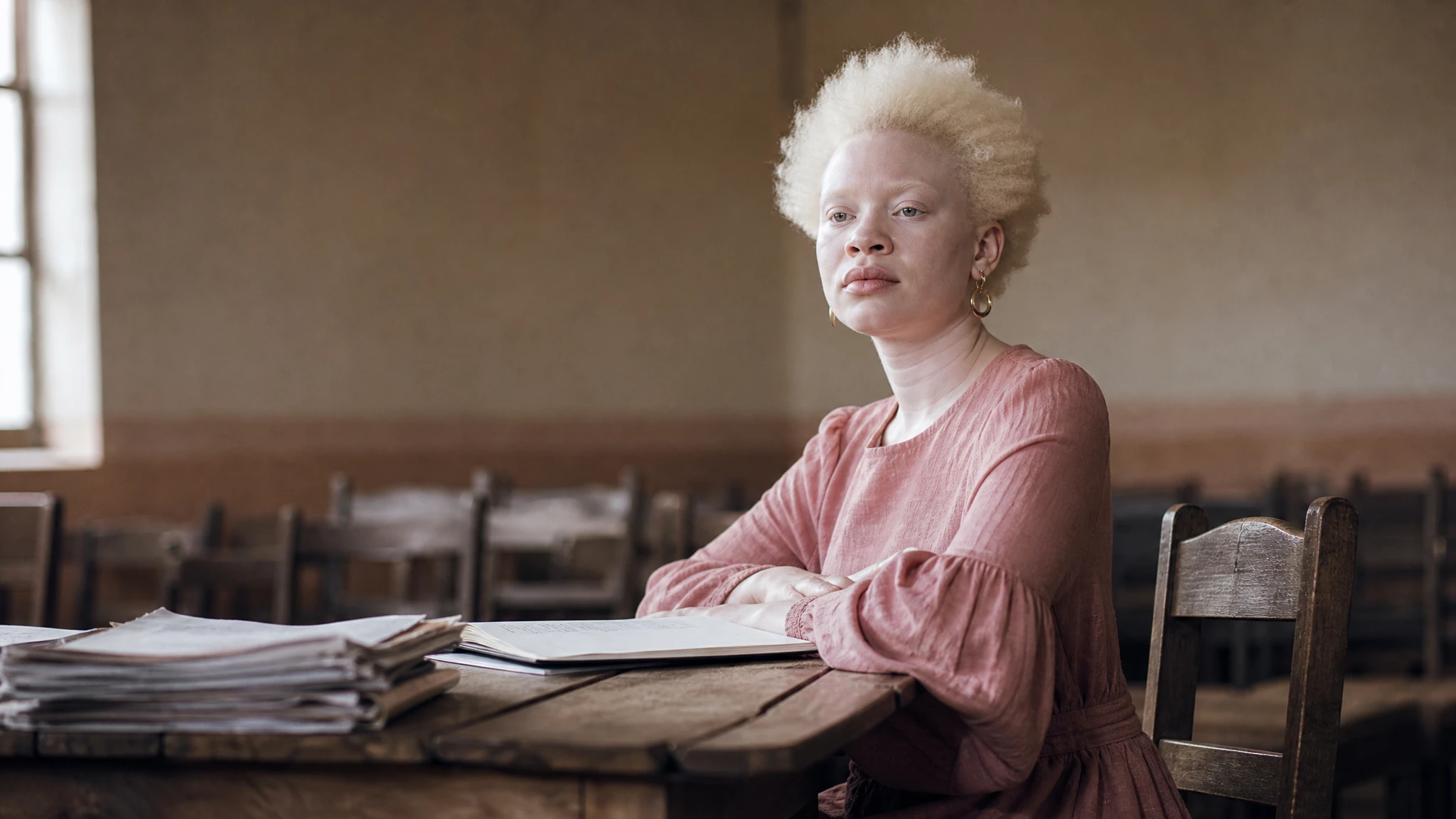 UN expert: albinism rights still face systemic barriers