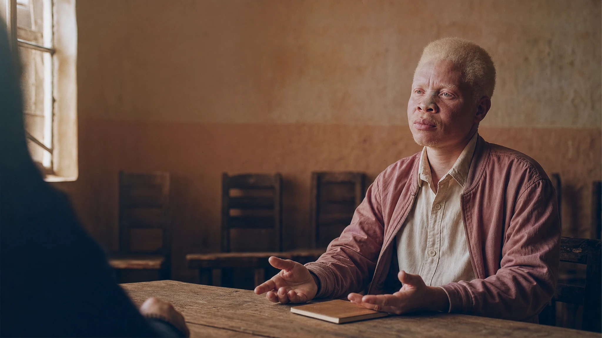 UN expert on albinism to visit Pakistan in 2026