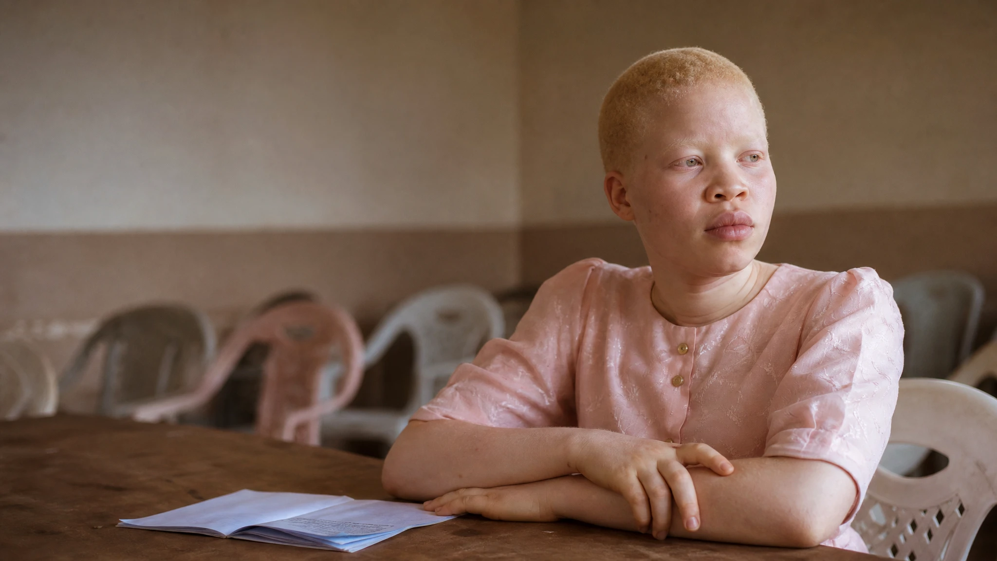 UN issues reporting guide for children with albinism
