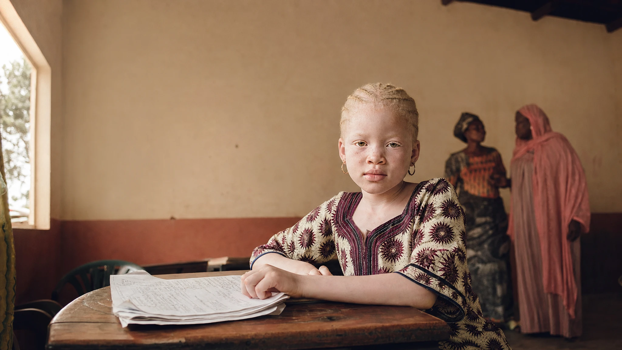 UN report documents children with albinism in Gambia