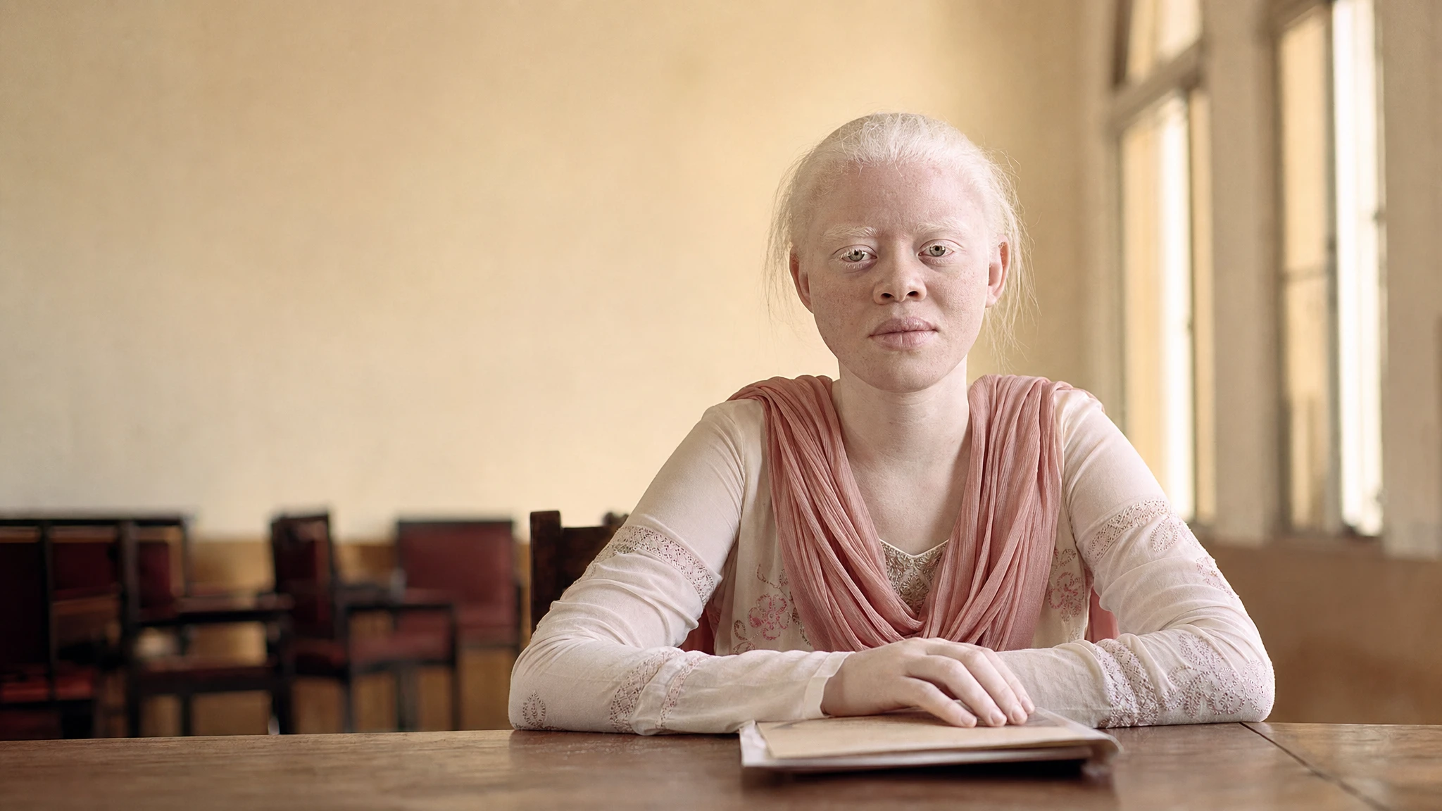 UN expert calls on Pakistan to protect people with albinism