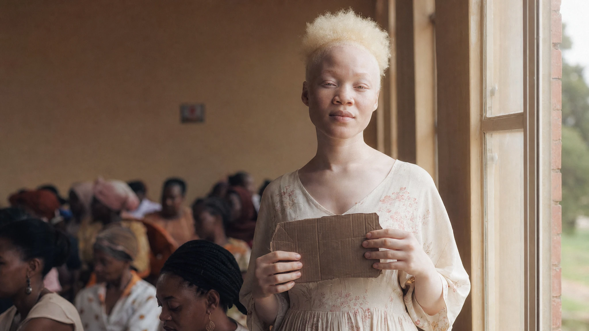 June 13 marks International Albinism Awareness Day