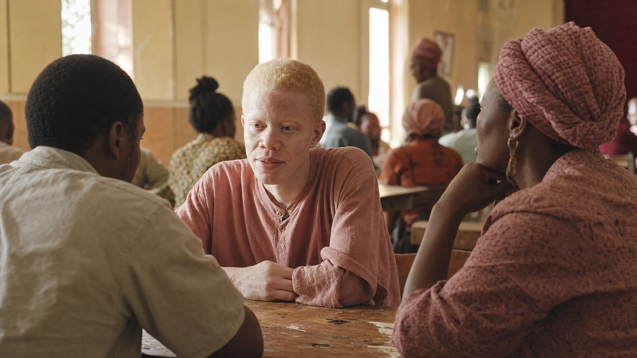 How the conversation around albinism is shifting