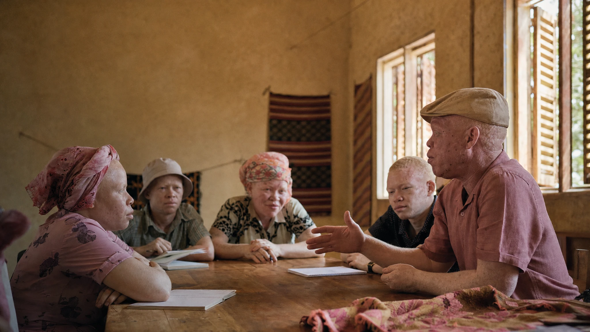 UNESCO strengthens albinism rights work in Zimbabwe