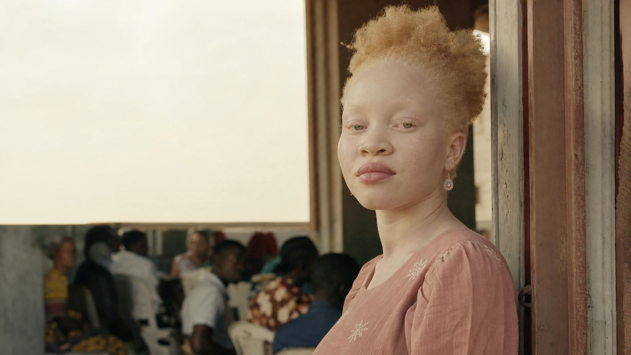 June 13: International Albinism Awareness Day observed globally