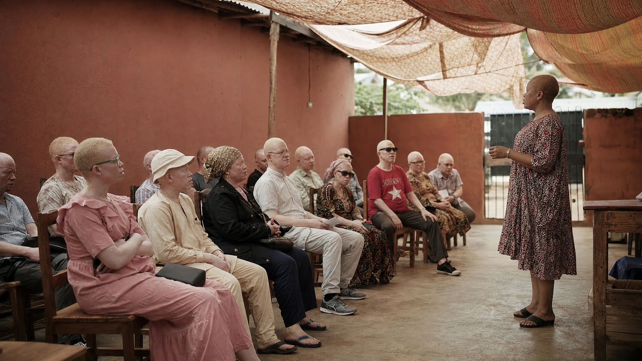 Nigeria's First Lady calls for albinism inclusion