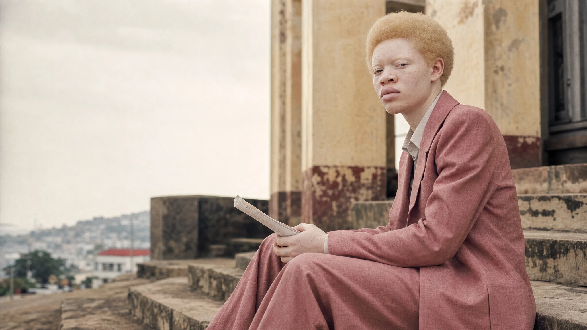 People with albinism in Liberia report government neglect