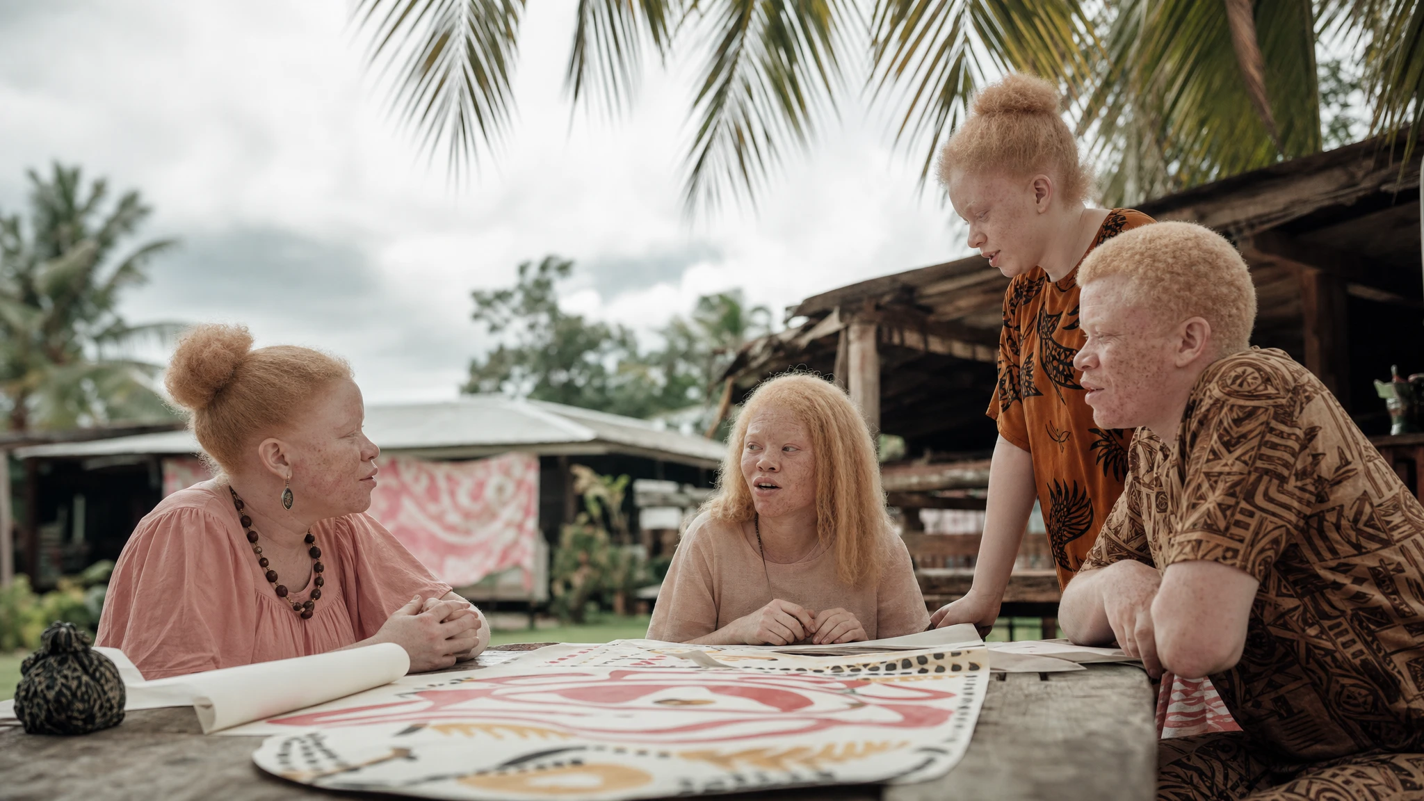 Fiji prepares to mark International Albinism Awareness Day