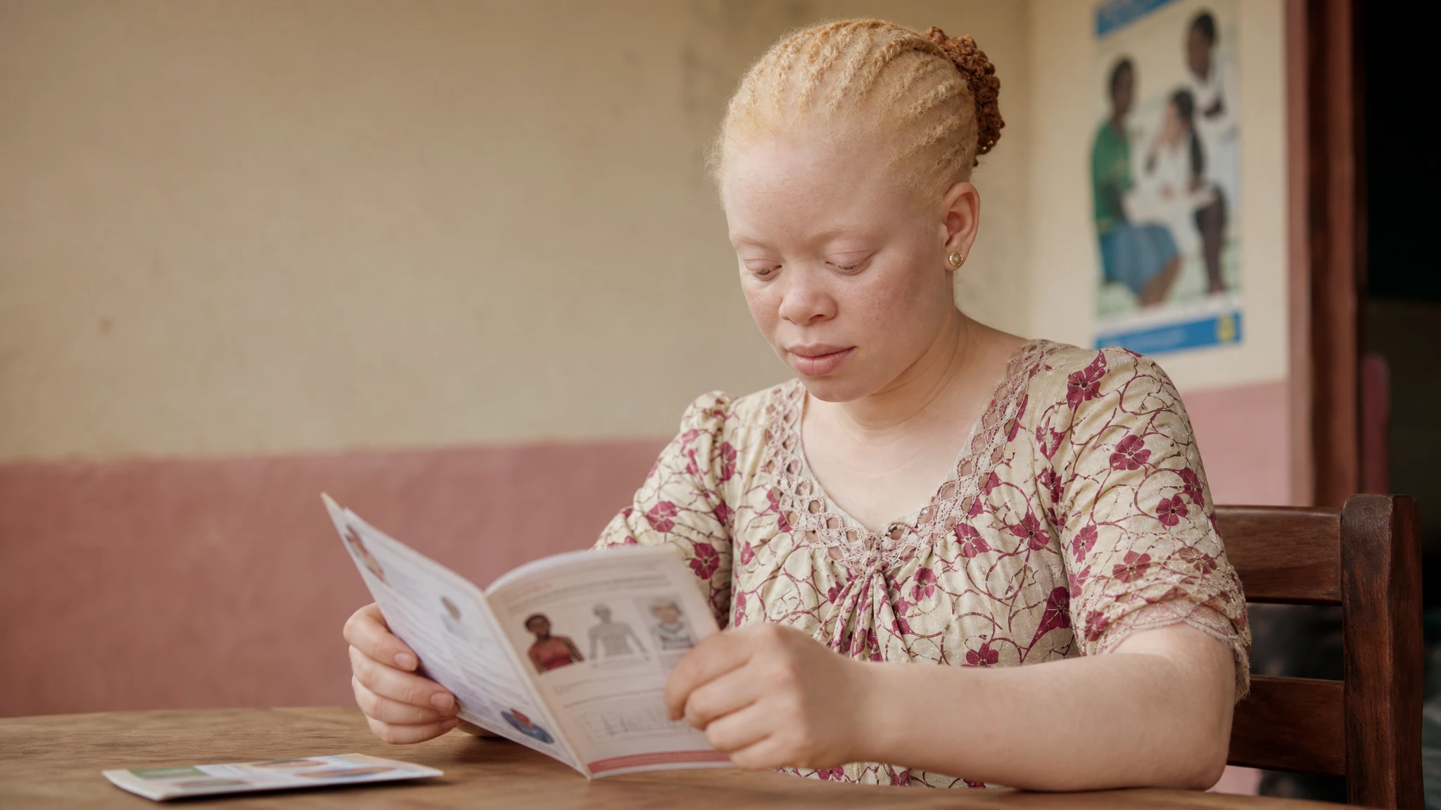 Skin bleaching is not albinism, doctors clarify