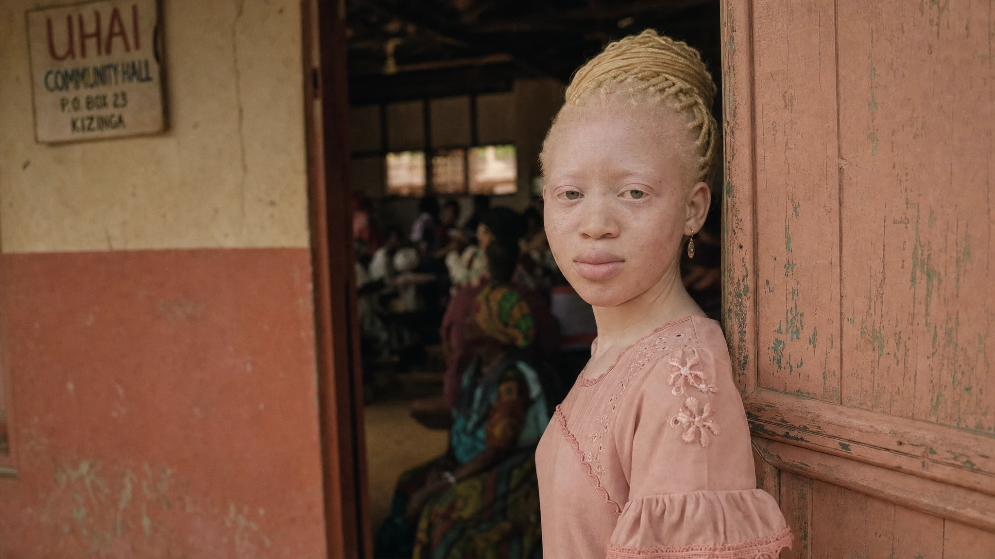 Calls grow to end discrimination against people with albinism
