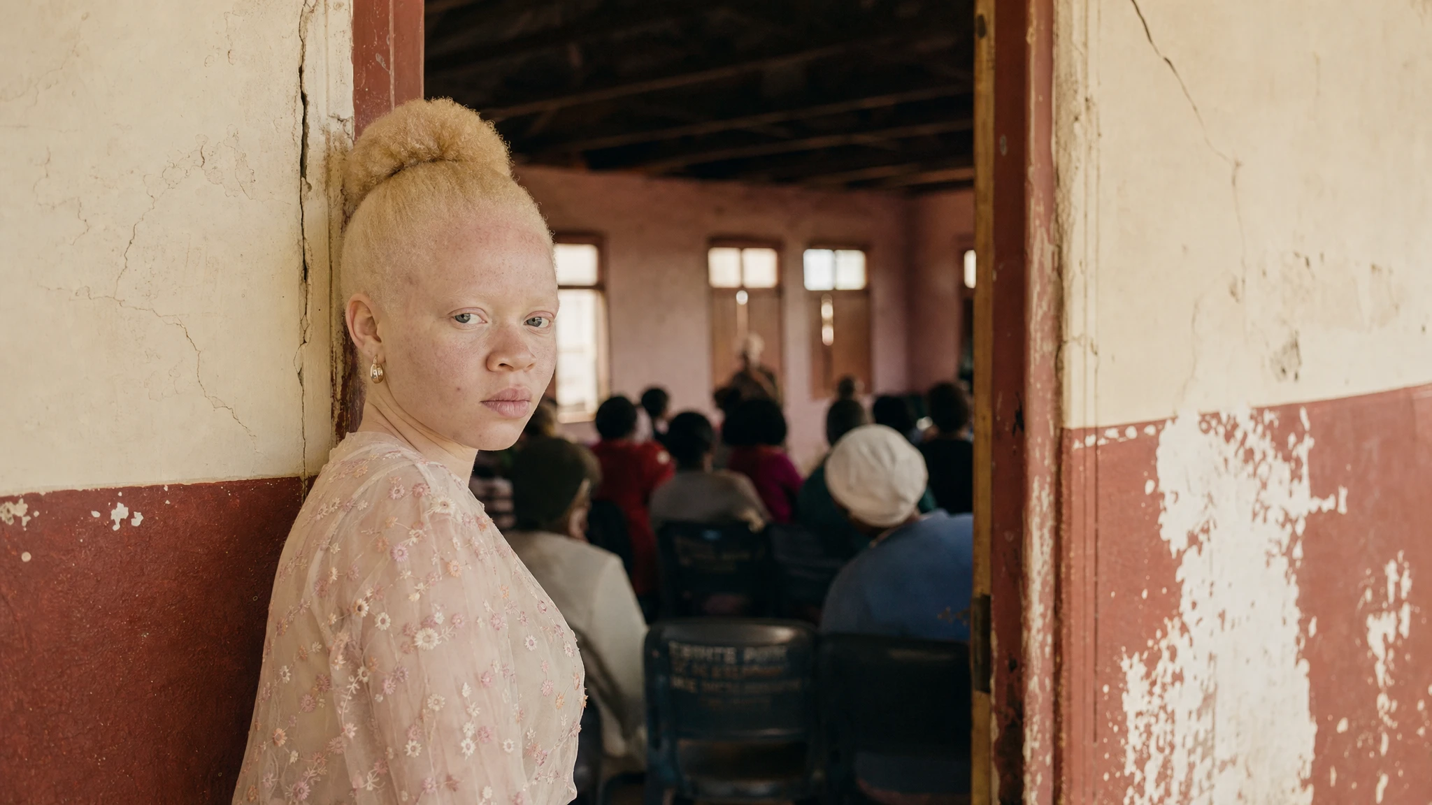 South Africa marks albinism awareness with renewed calls