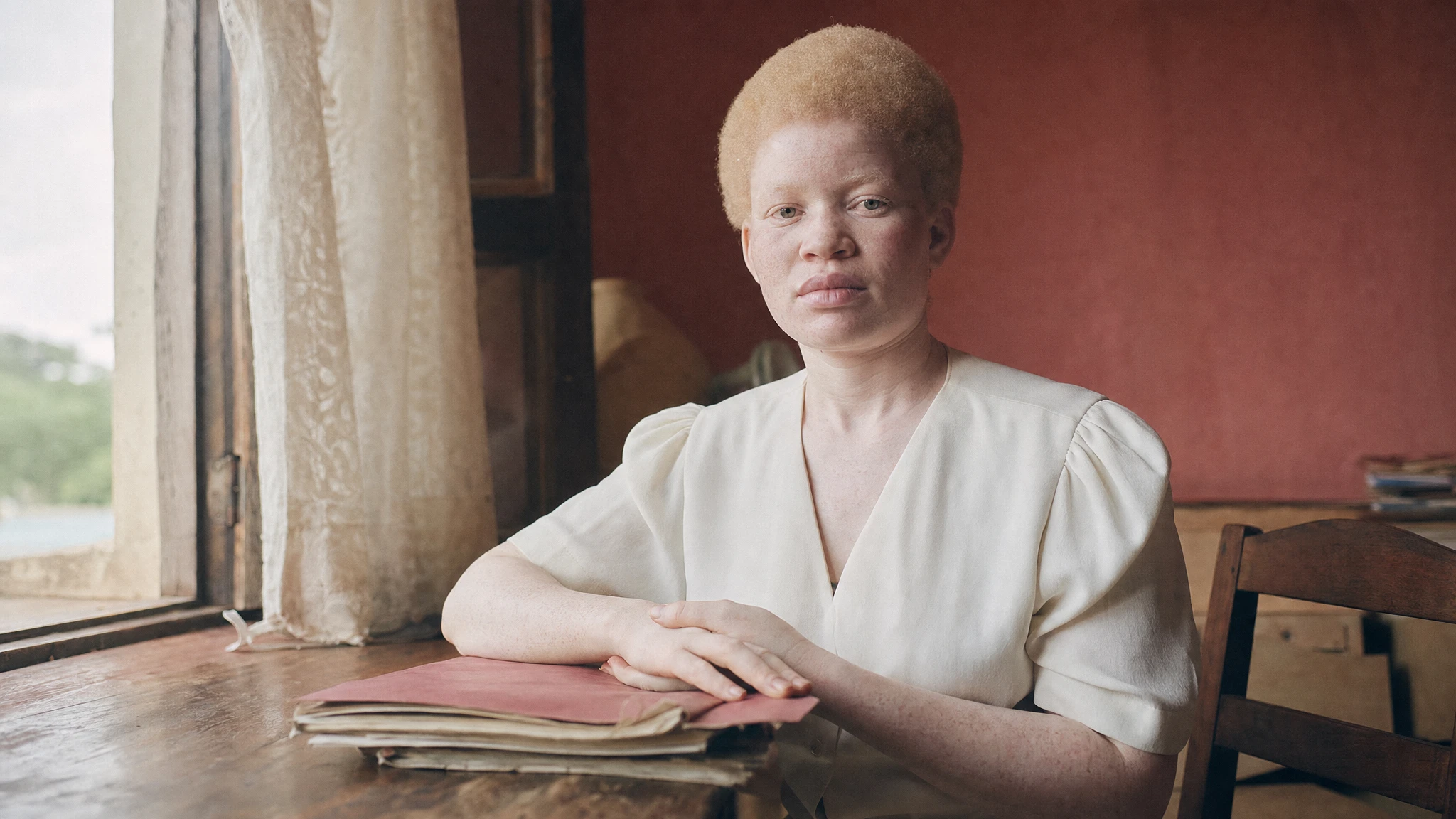 Ugandans with albinism call for equal hiring
