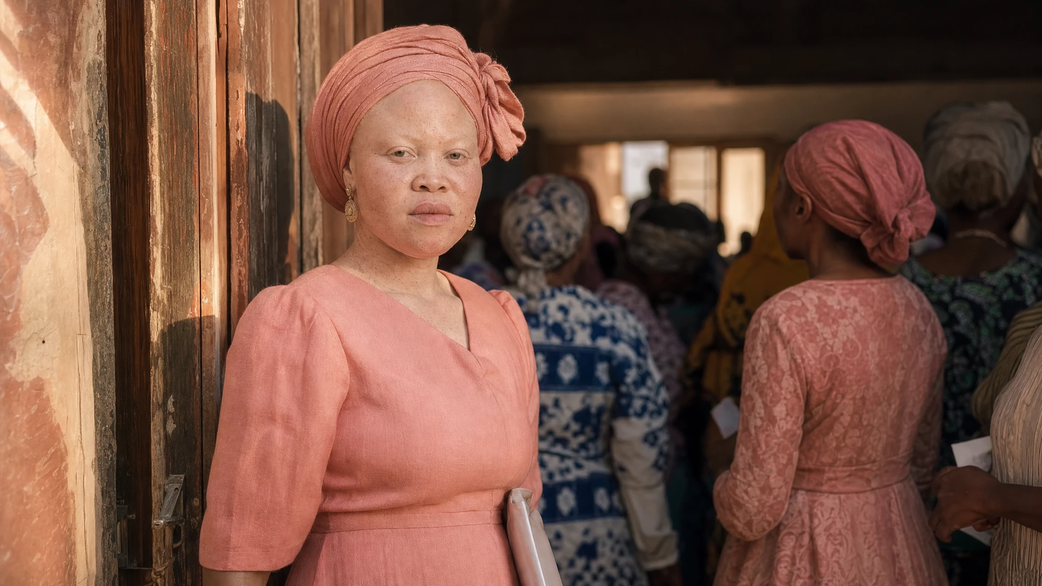 Kenya gender commission calls for stronger albinism protections