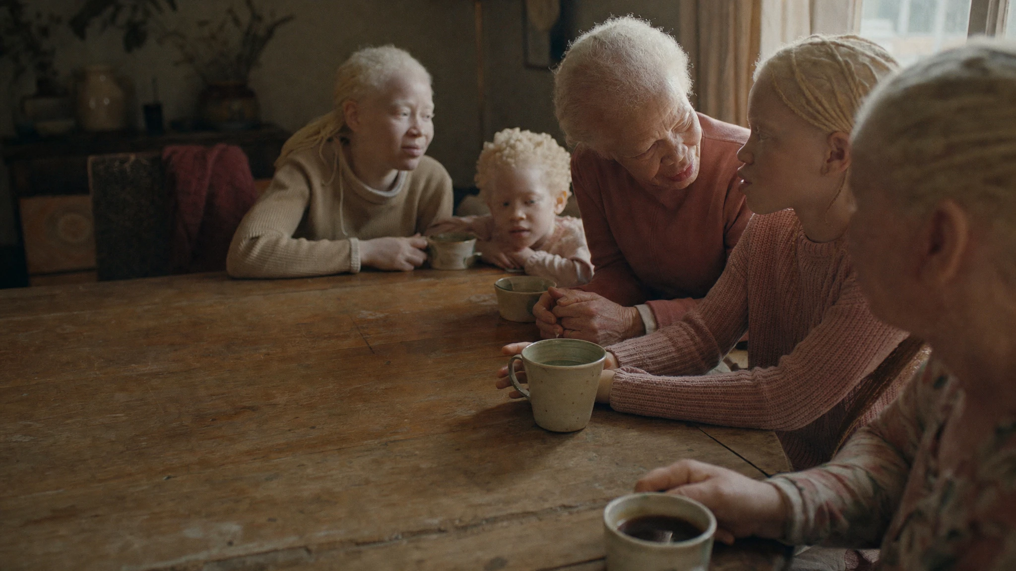 A family speaks ahead of World Albinism Awareness Day