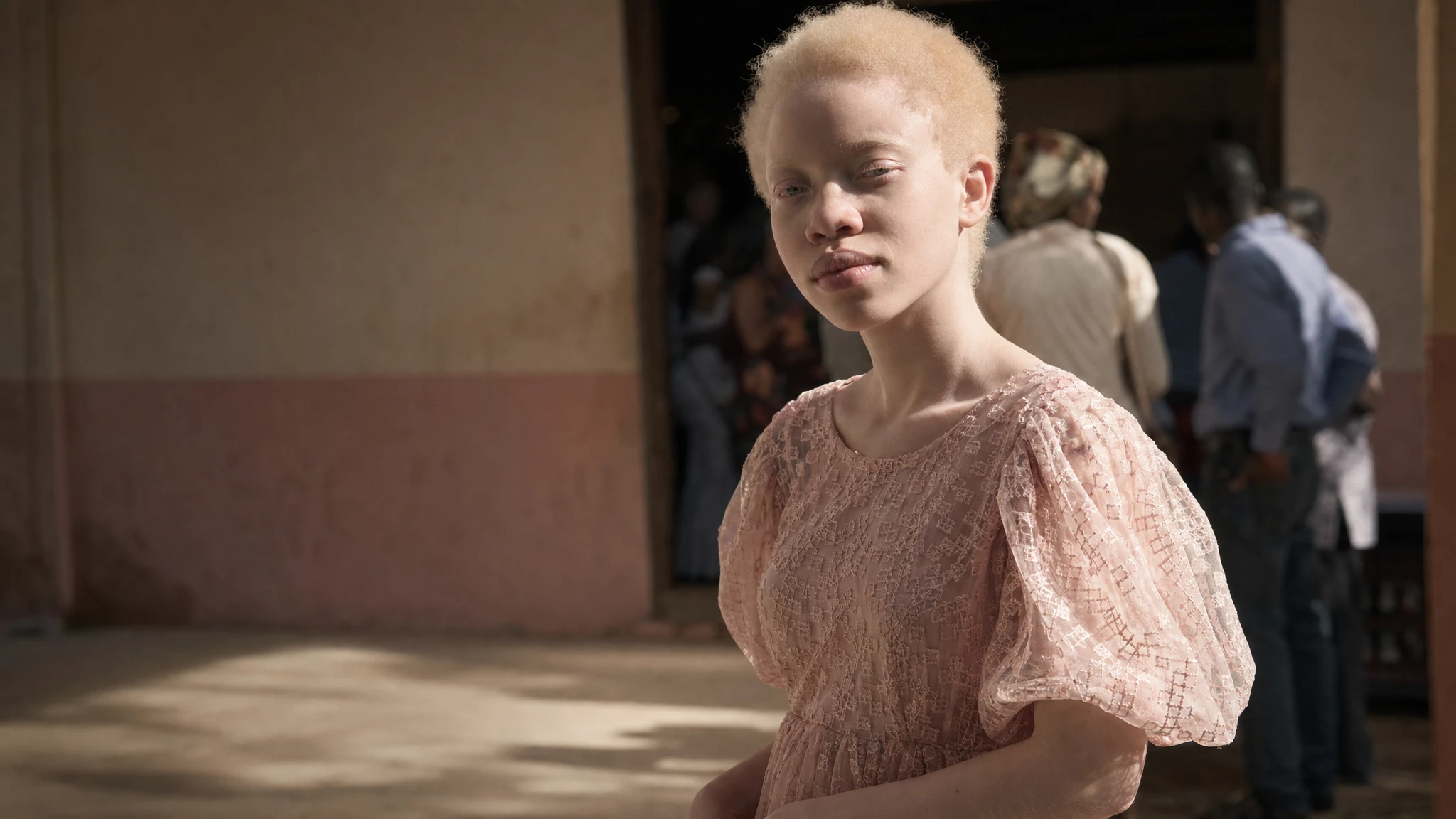 South Africa marks International Albinism Awareness Day 2024