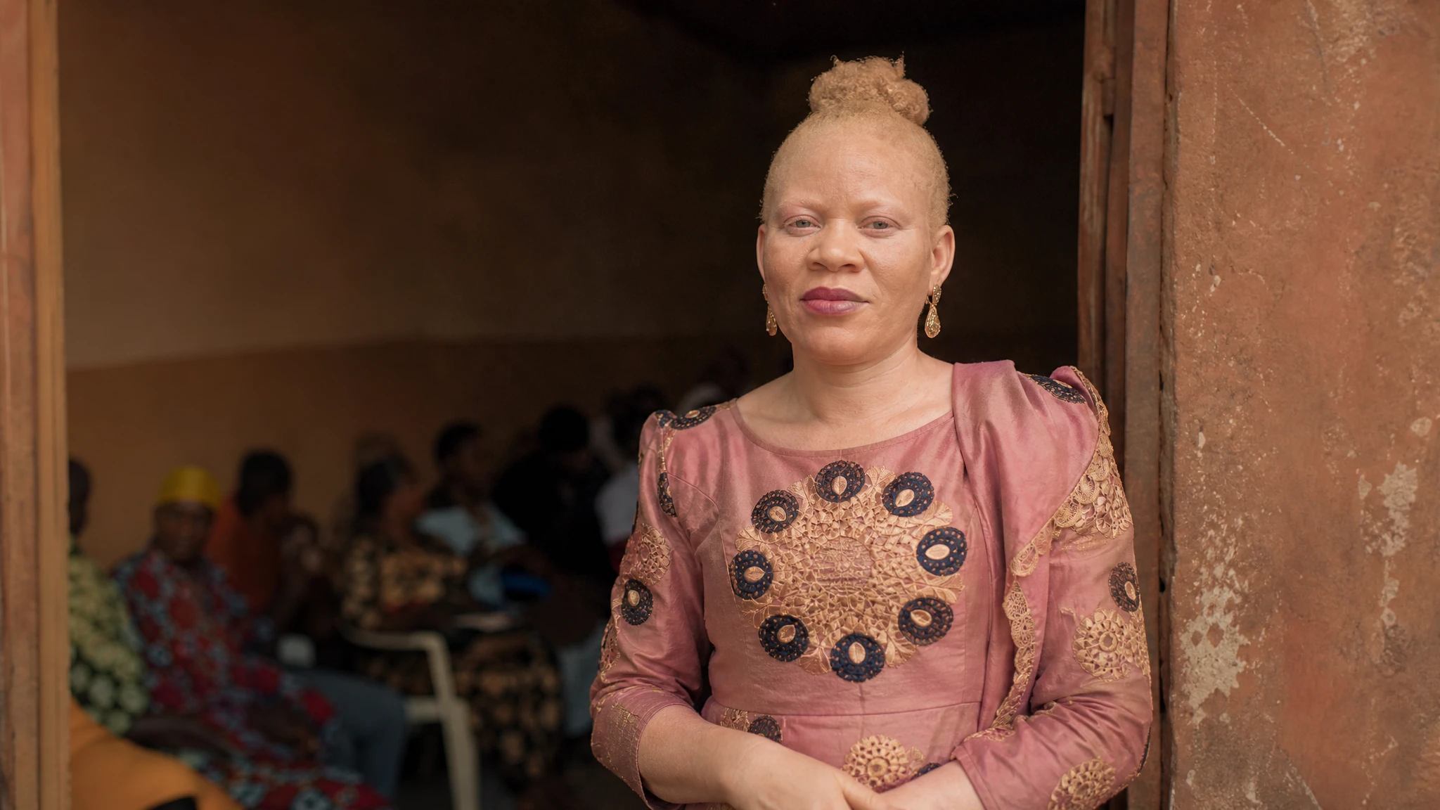 Nigeria launches campaign to promote albinism dignity