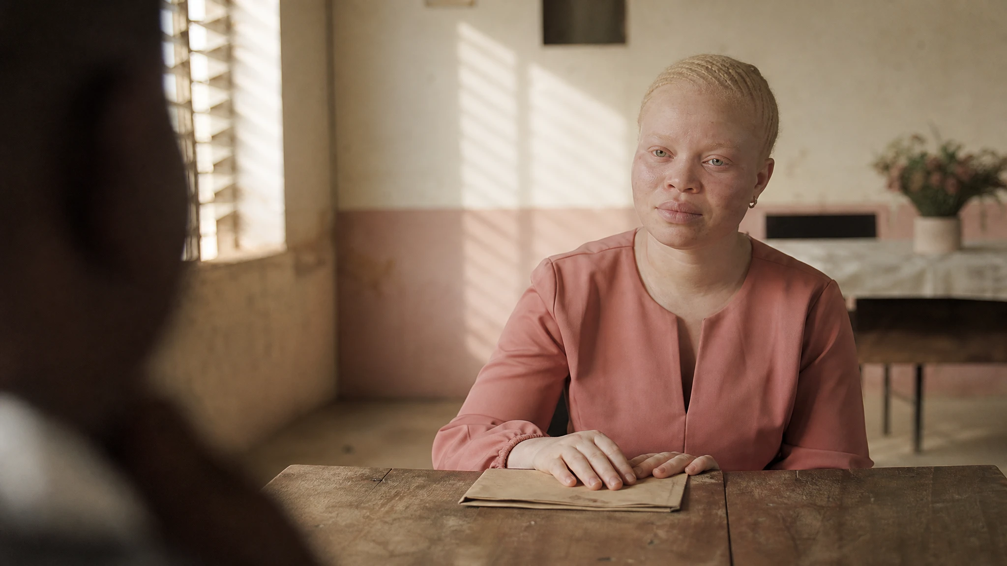 UN calls for essential healthcare for Zimbabweans with albinism