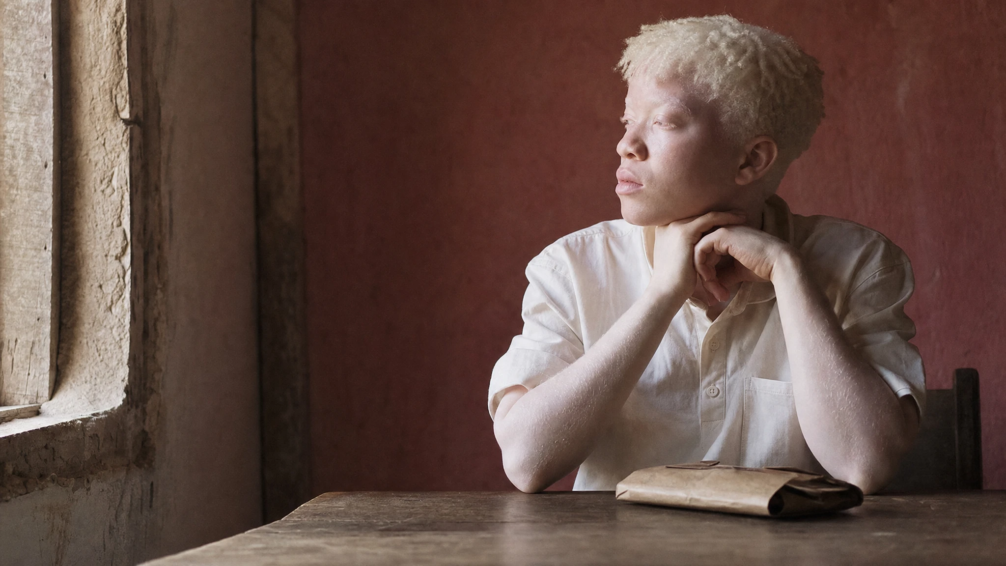 The hidden risks facing migrants with albinism