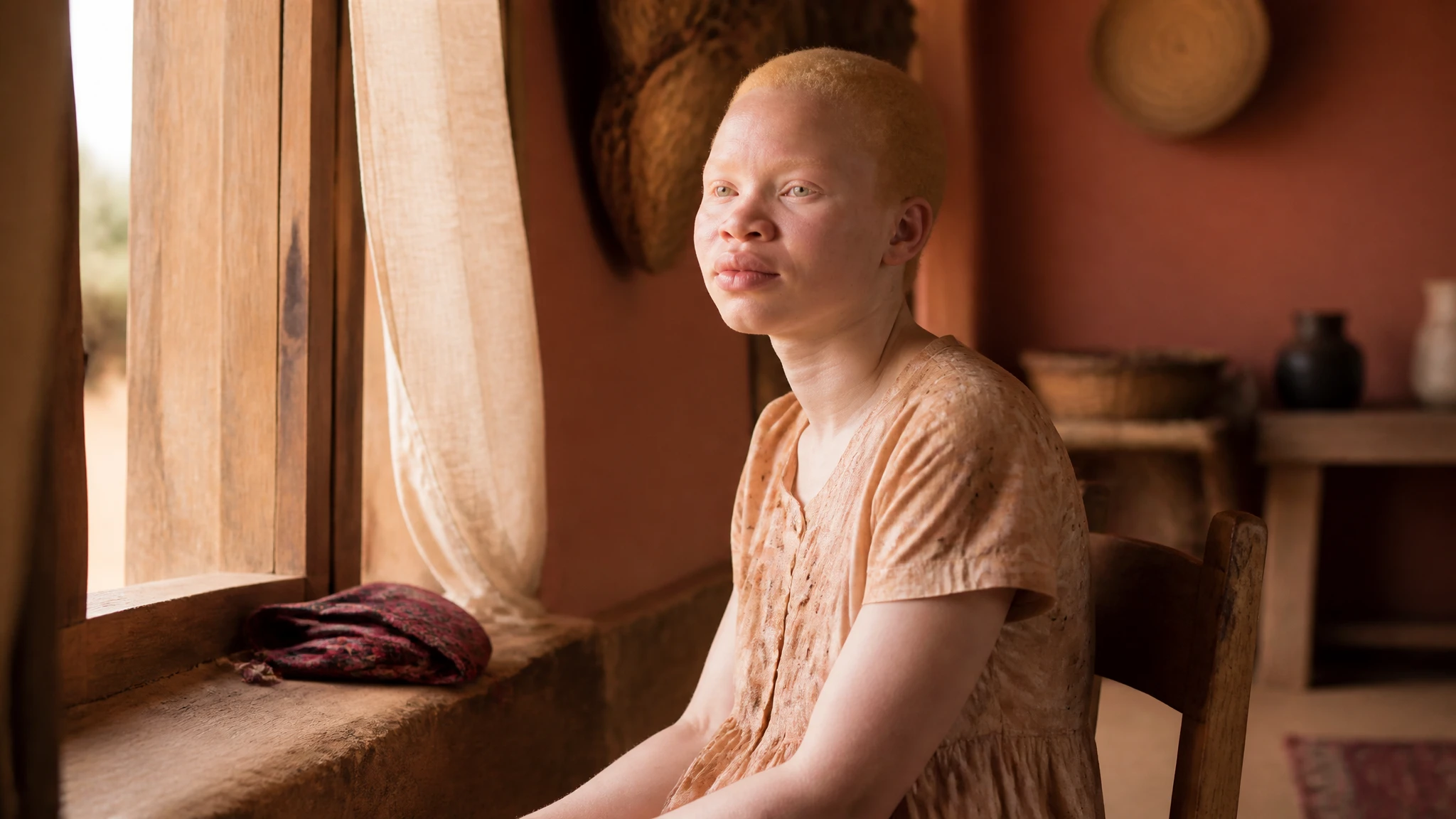 UN resettles people with albinism fleeing Malawi threats