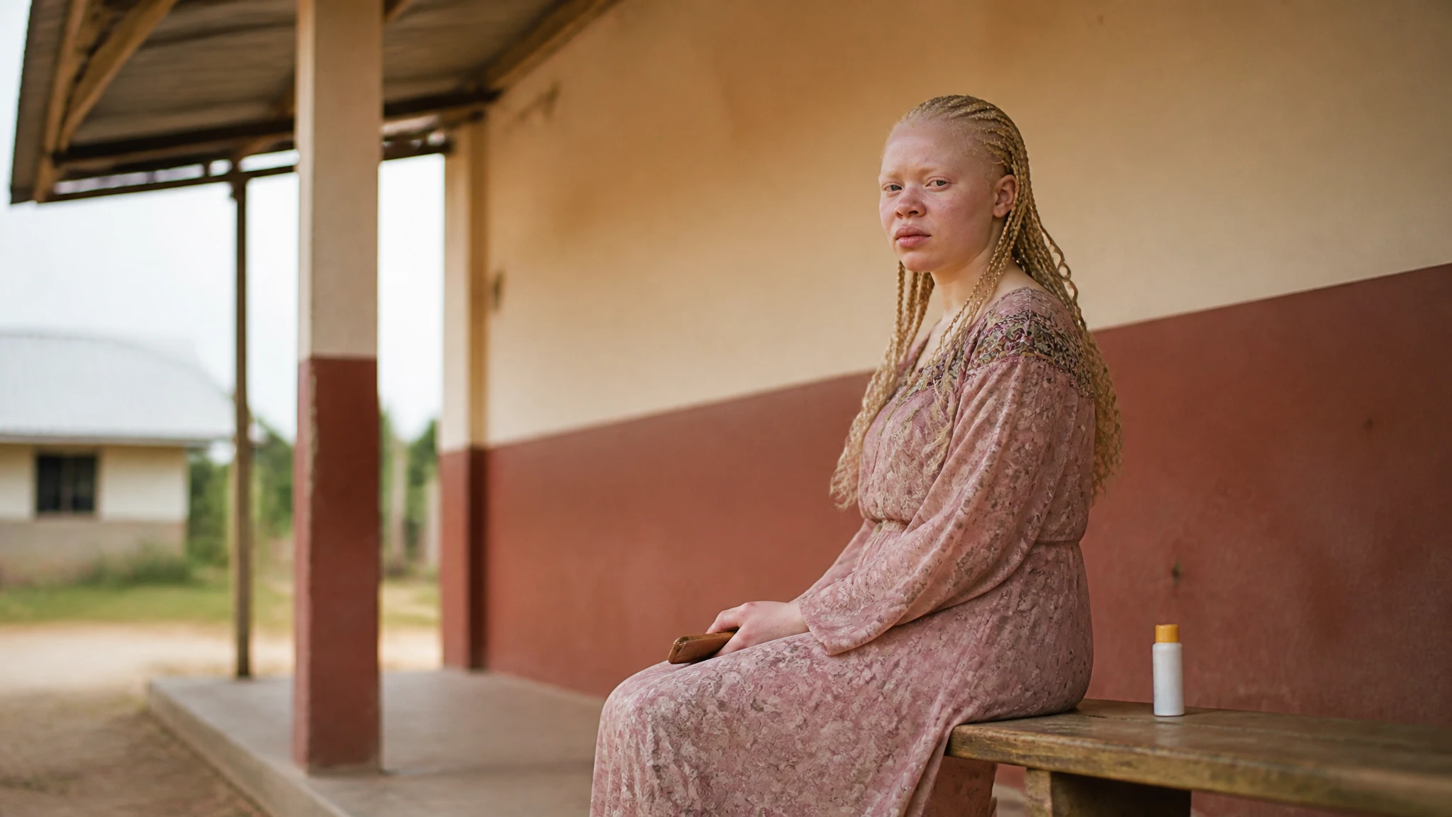 Abia state proposes monthly cancer screening for albinism community