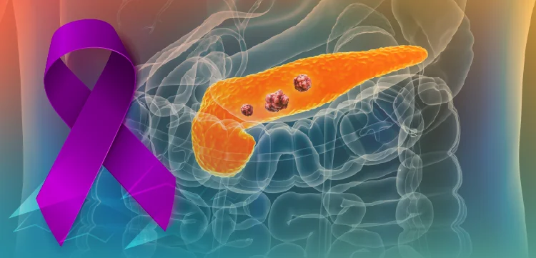 Evolving Treatment Strategies in Pancreatic Cancer: Current Standards, Emerging Targets, and the Role of Molecular Testing