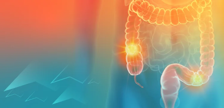 GI Tumor Board—Applying Recent Advances in Biomarker Testing and Treatment in Metastatic Colorectal Cancer