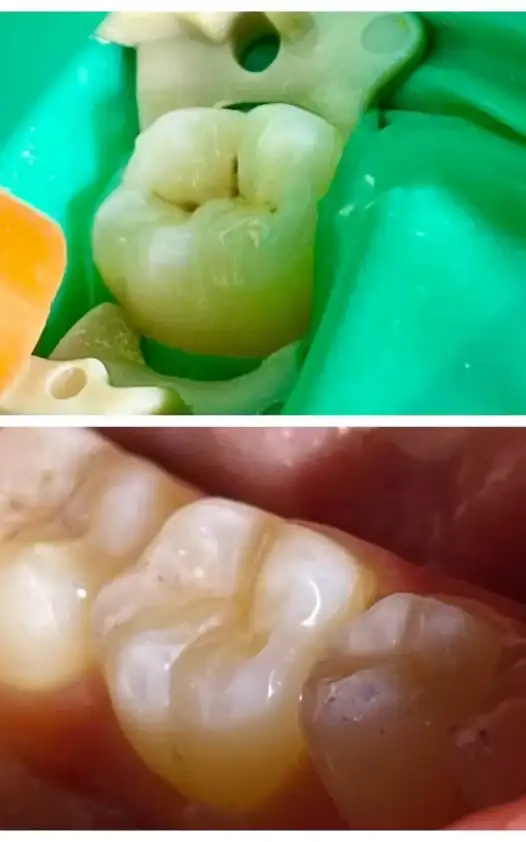 Адгезивные технологии