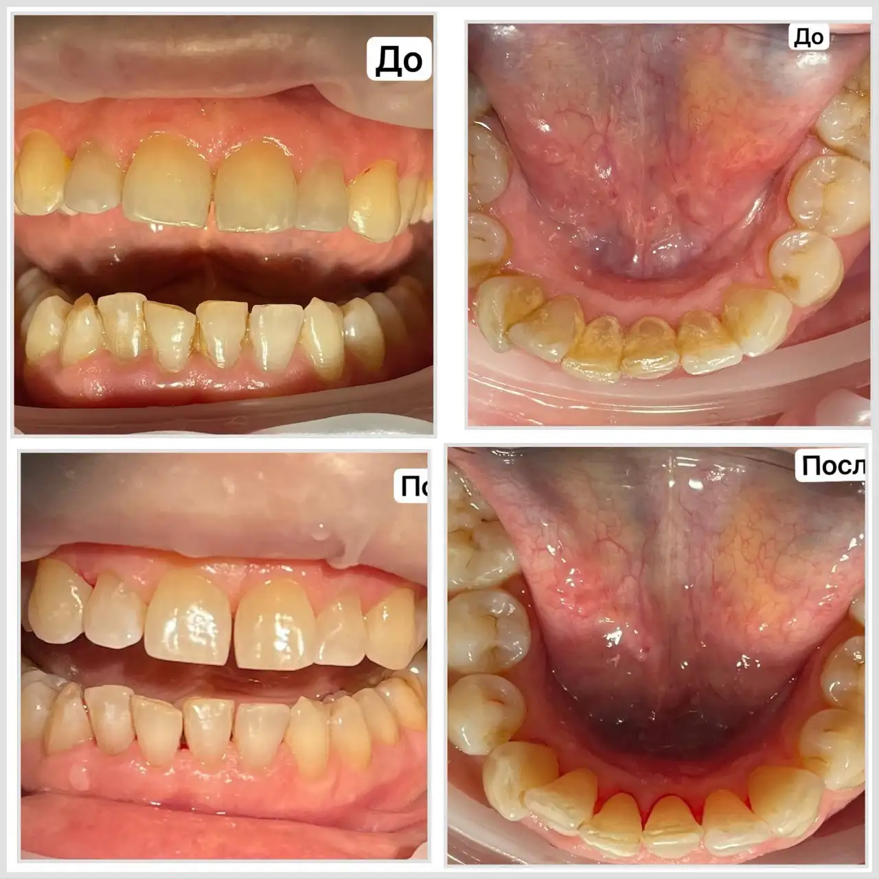 Профессиональная гигиена