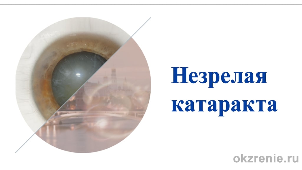 nezrelaya-katarakta-1.jpg