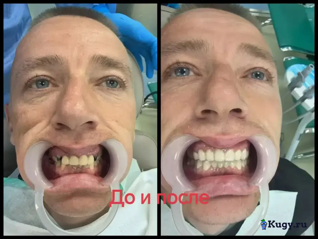 Лечение и протезирование зубов в г. Хэйхэ