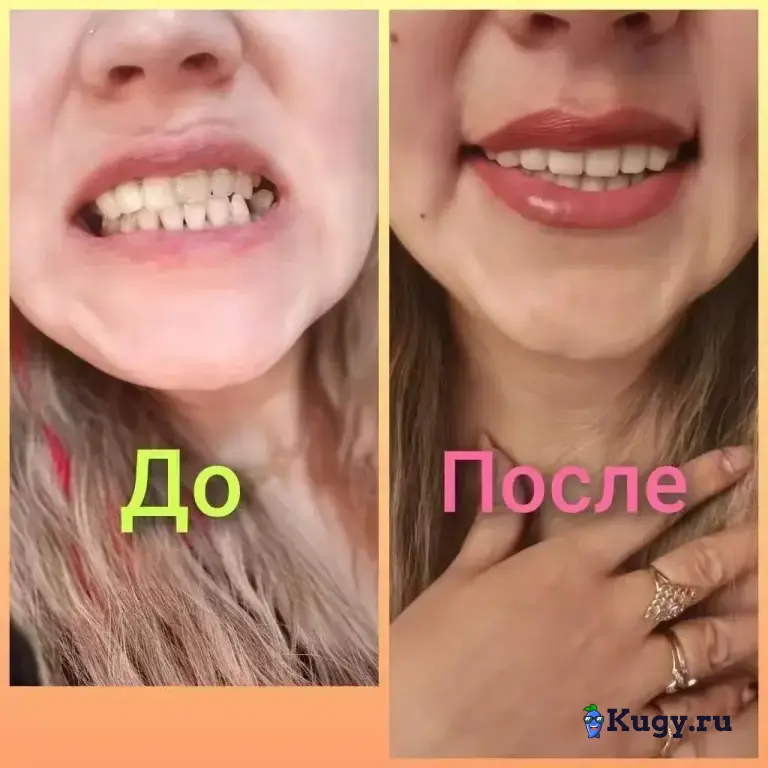 Лечение и протезирование зубов в г. Хэйхэ