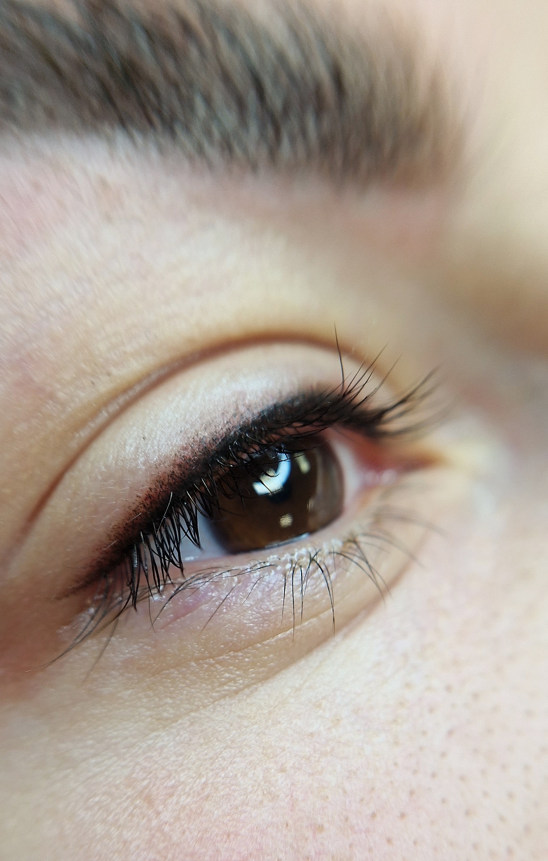 Межресничка