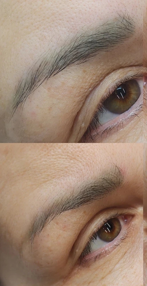 Удаление ремувером