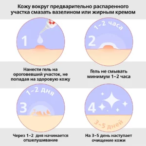 Alternative view of Антипапиллом гель, 5 мл