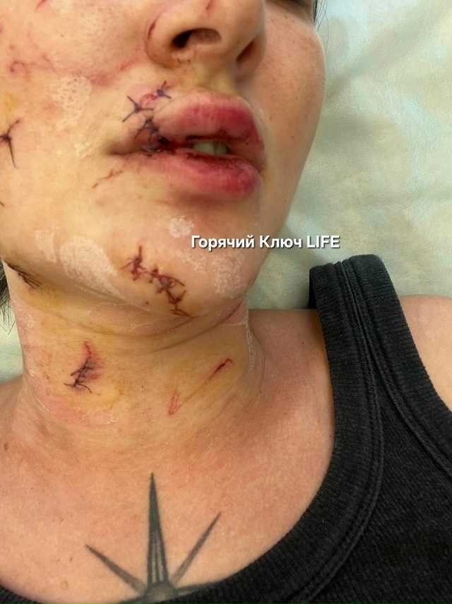 В Горячем Ключе возбудили дело после избиения посетительницы бара