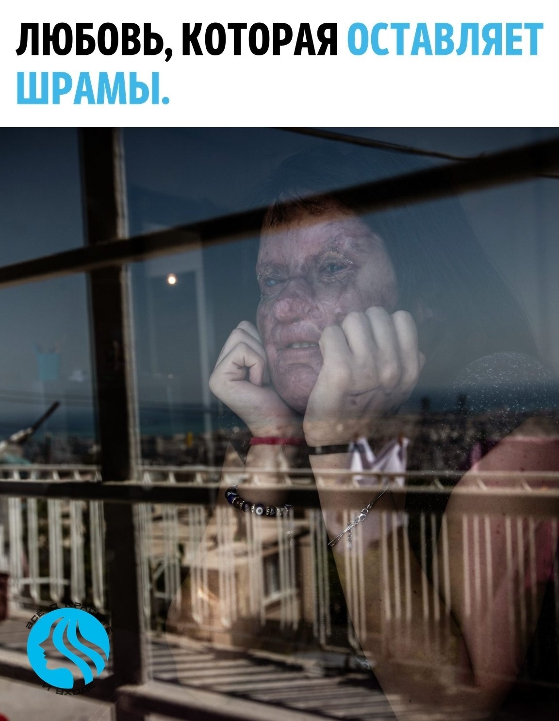 В Турции 20-летняя Берфин Озек состояла в отношениях с 23-летним Каримом Озоном …