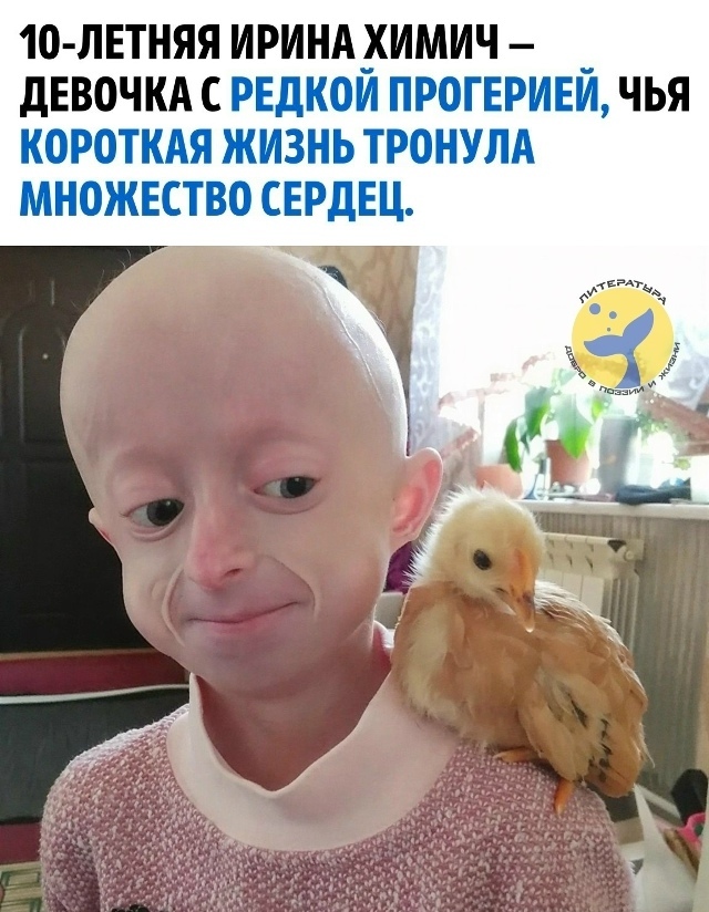 Её организм поражал синдром Хатчинсона — Гилфорда (прогерия): ткани и органы ста…