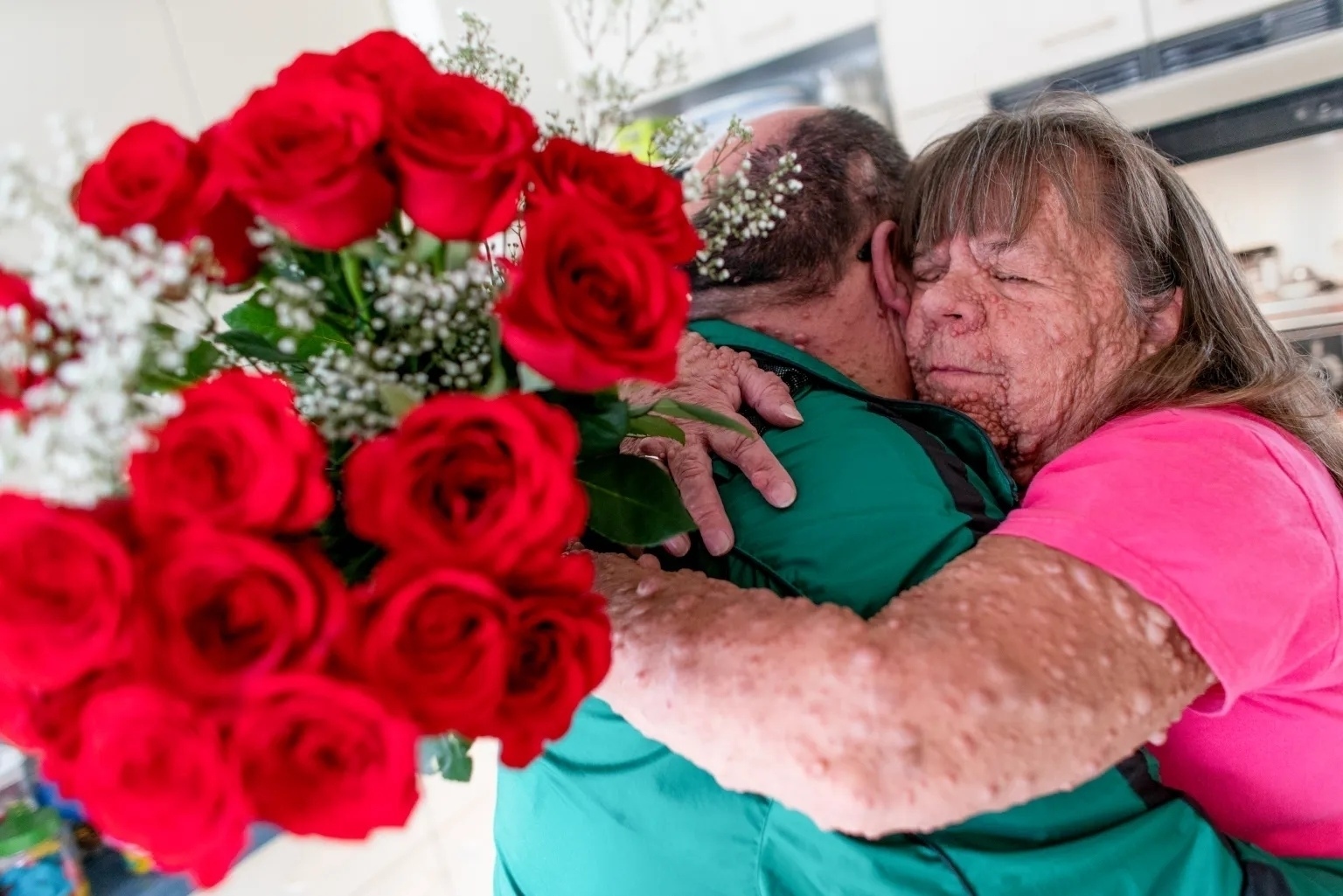 💞 История, которая доказывает: любовь сильнее предрассудков.
58-летняя Гейл Апп…
