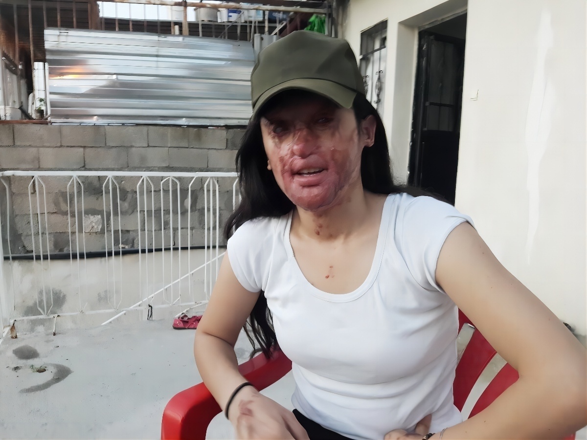 В Турции 20-летняя Берфин Озек состояла в отношениях с 23-летним Каримом Озоном …