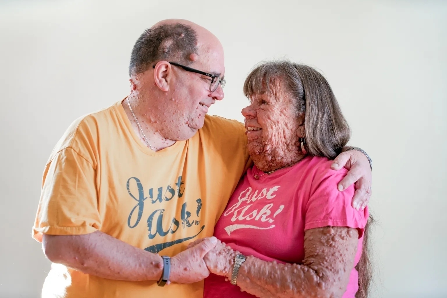 💞 История, которая доказывает: любовь сильнее предрассудков.
58-летняя Гейл Апп…