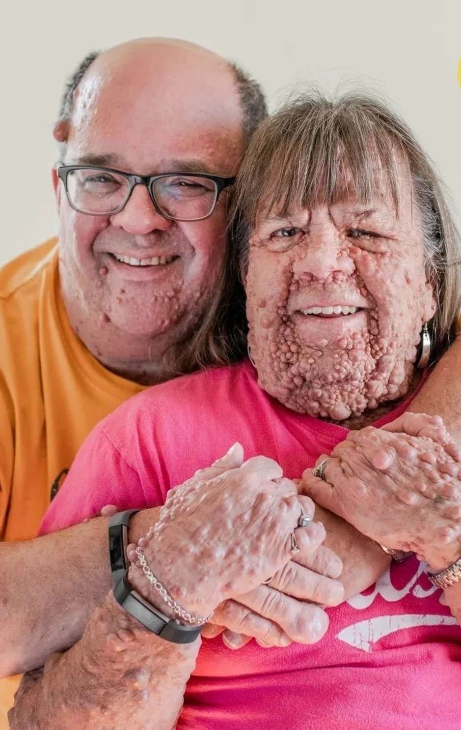 💞 История, которая доказывает: любовь сильнее предрассудков.
58-летняя Гейл Апп…