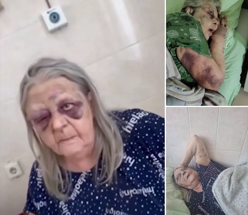 В кемеровской больнице медики избили 76-летнюю бабушку и привязали ее к кровати.…