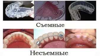 изображение из решения ППС