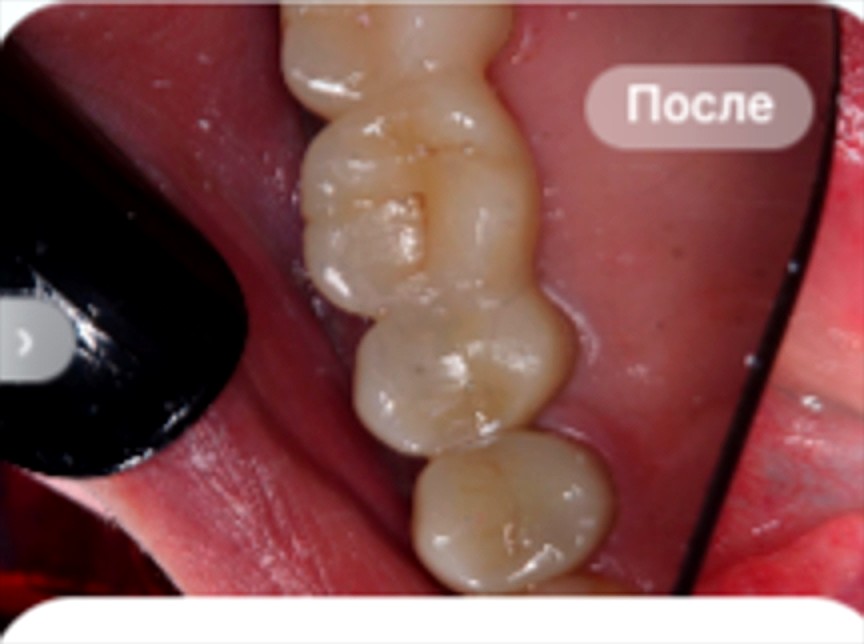 После лечения