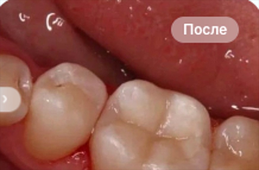 После лечения