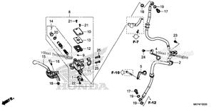 Front Brake Master Cylinder (1)