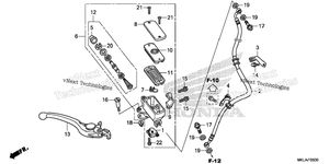 Front Brake Master Cylinder (1)