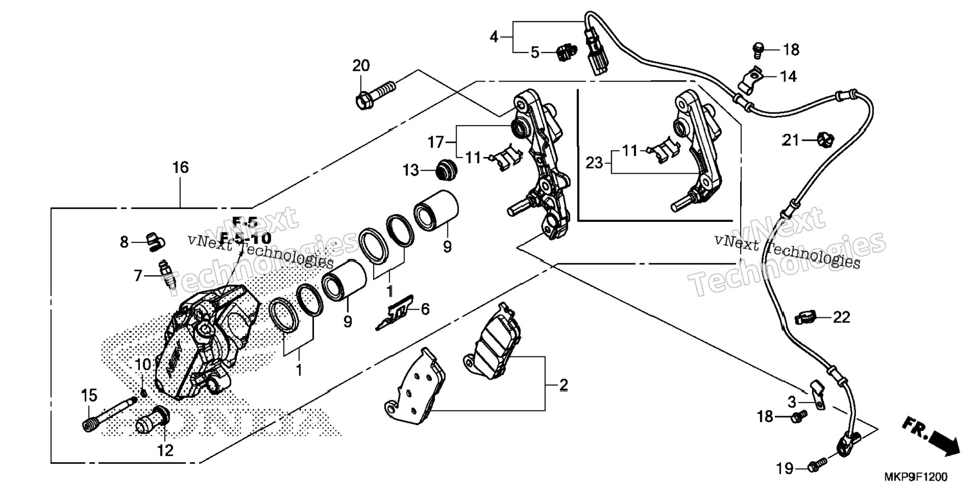 Front Brake Caliper (1)